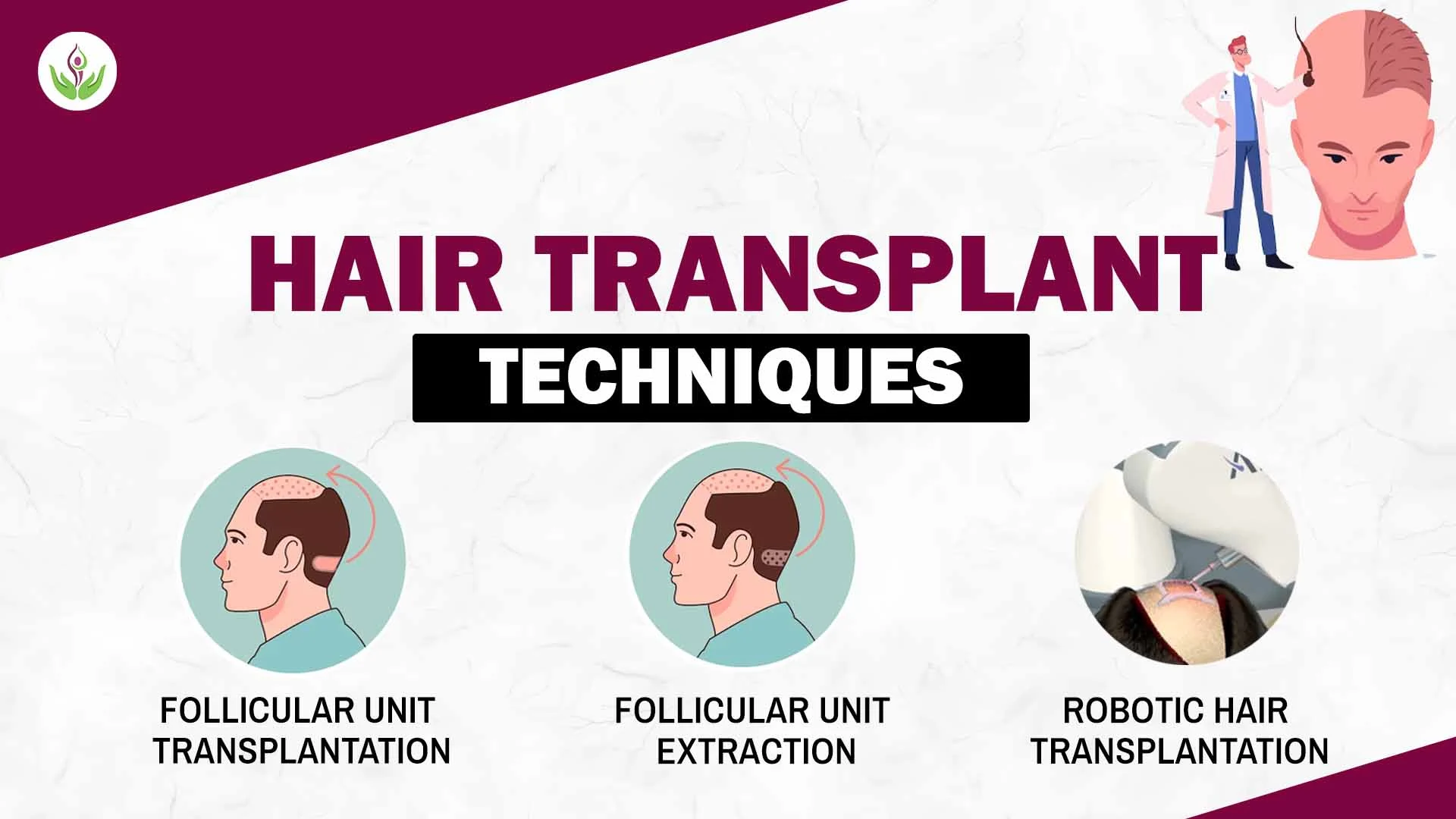 Hair Transplant Techniques