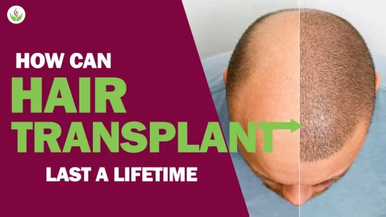 How Can Hair Transplant Last Lifetime