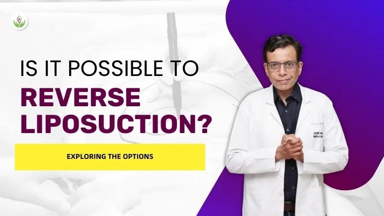 Is It Possible to Reverse Liposuction? Exploring the Options