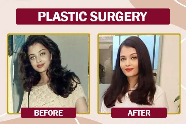 Aishwarya Rai Bachchan plastic surgery before and after photo