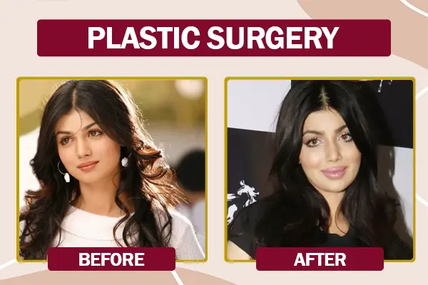 Ayesha Takia Plastic Surgery Before and After Photo