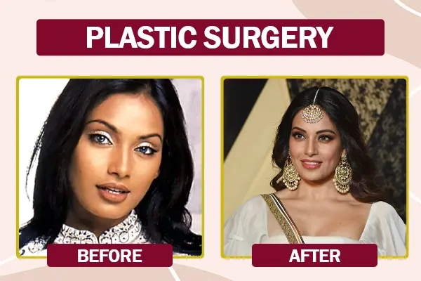 Bipasha Basu Plastic Surgery Before and After Photo