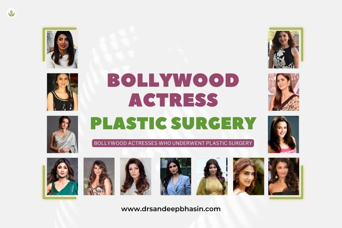 Glamorous Bollywood Stars: Stories of How Plastic Surgery Changed Their Looks