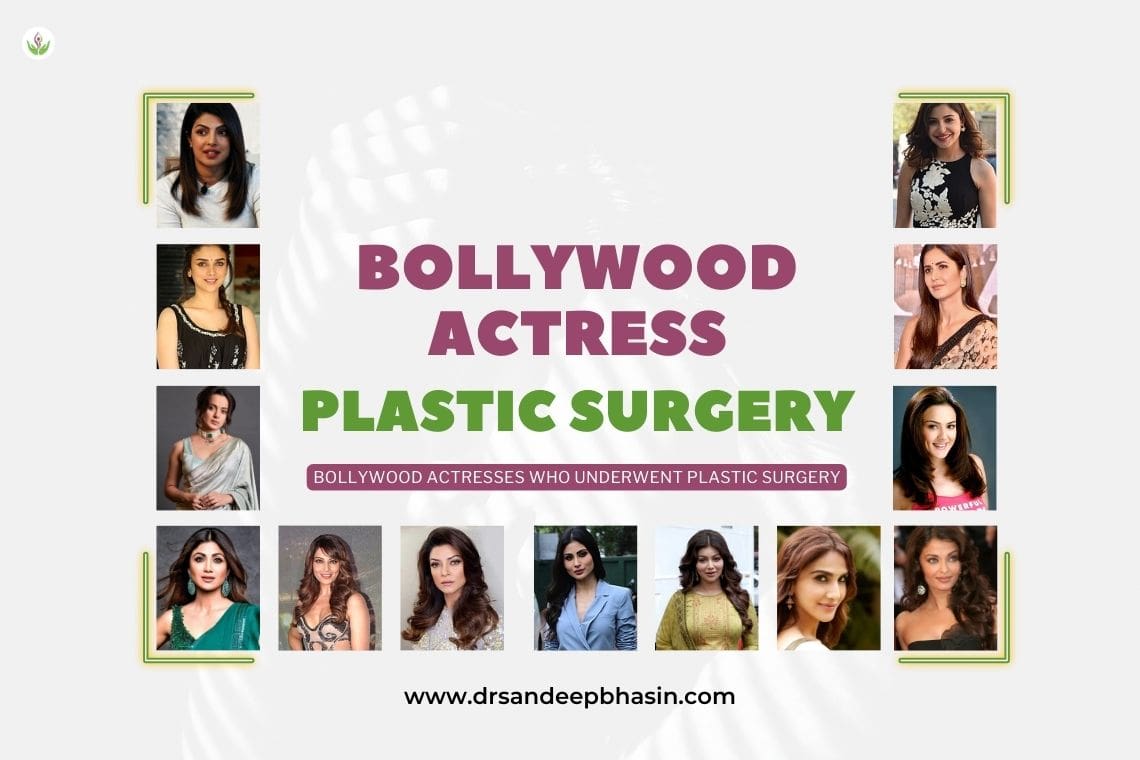 Bollywood Actresses Who Underwent Plastic Surgery