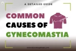 Common Causes of Gynecomastia