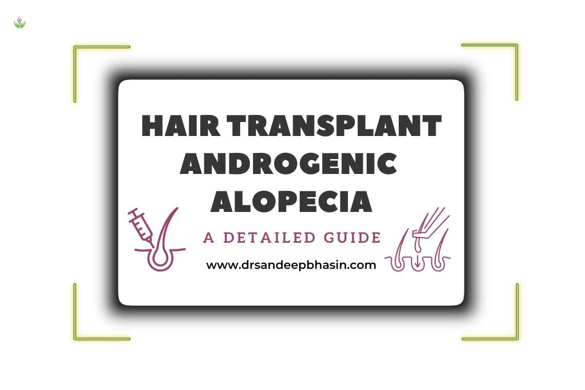 Hair Transplants for Androgenic Alopecia
