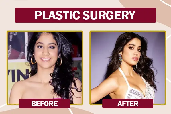 Janhvi Kapoor plastic surgery before and after photo