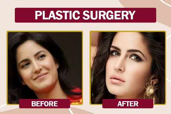 Katrina Kaif cosmetic treatment before and after photo