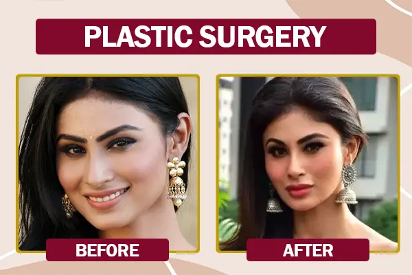 Mouni Roy Plastic Surgery Before and After Photo