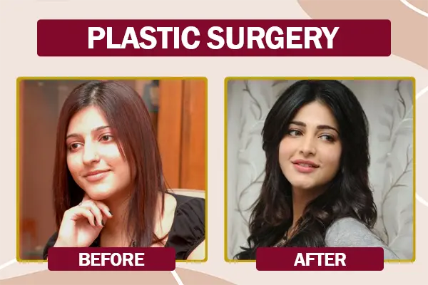 Shruti Haasan Plastic Surgery Before and After Photo