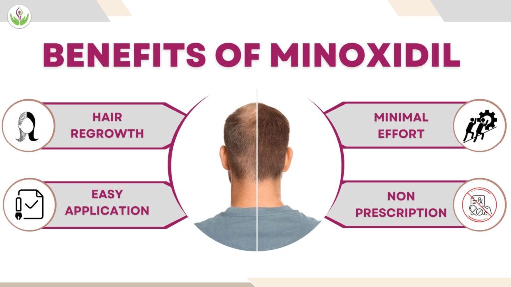 Benefits of Minoxidil - Promotes Hair Growth