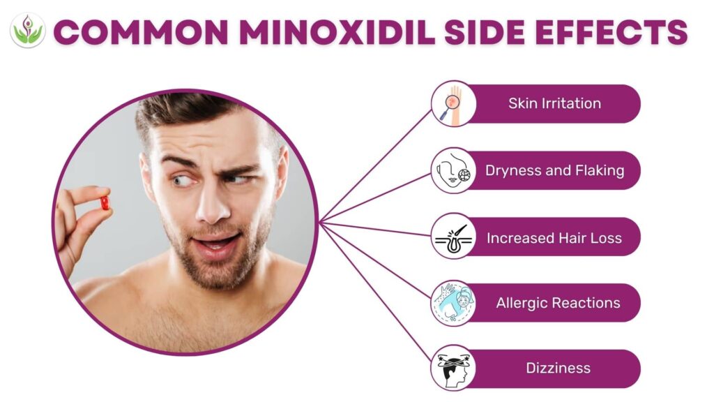 Minoxidil Side Effects