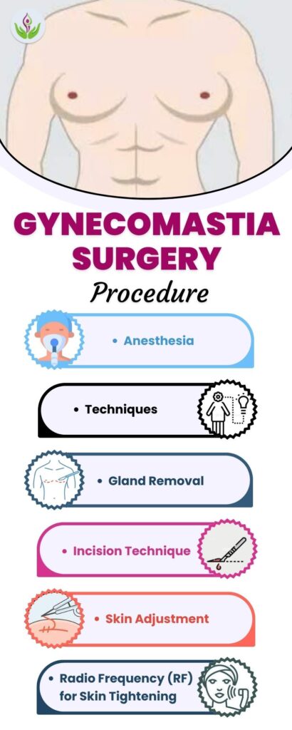 Gynecomastia Surgery Procedure