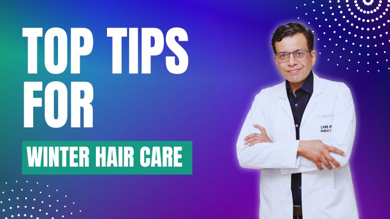 Top Tips for Winter Hair Care