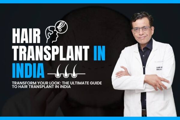 Ultimate Guide to Hair Transplant in India