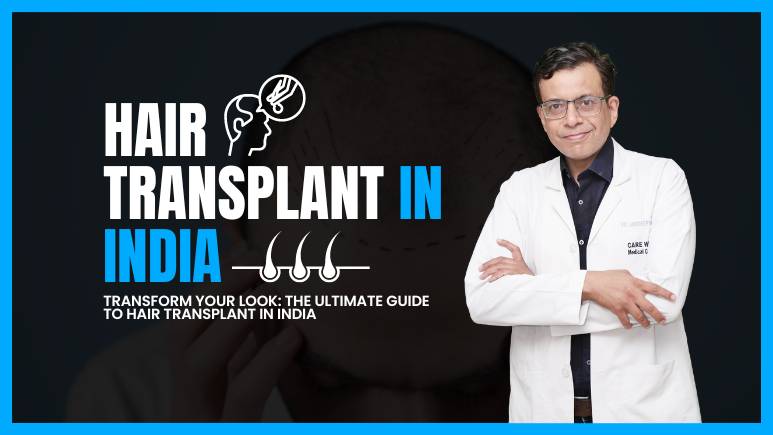 Ultimate Guide to Hair Transplant in India