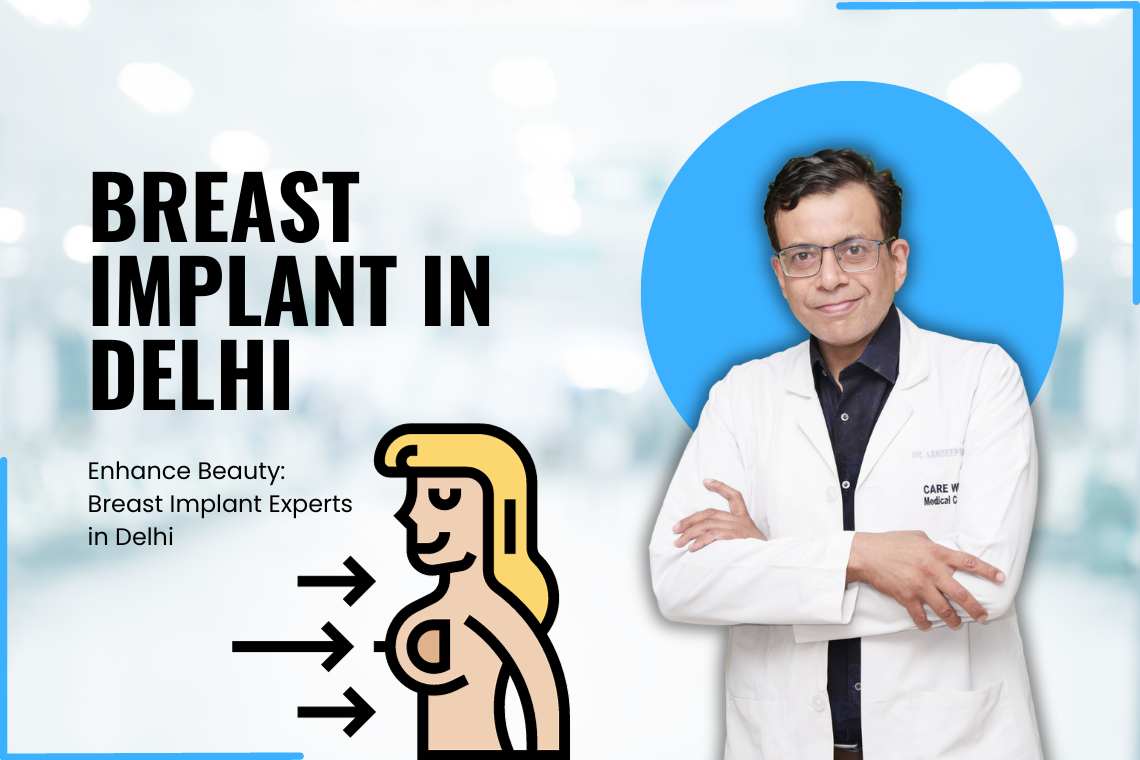 Breast Implant in Delhi