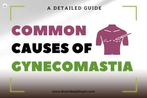 Common Causes of Gynecomastia: A Detailed Guide