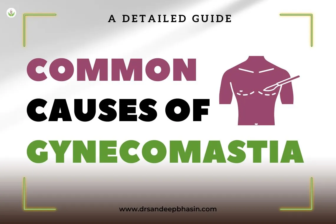 Common Causes of Gynecomastia: A Detailed Guide